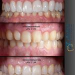 دکتر دندانپزشک فرین شمشیرگر