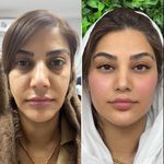 خدمات زیبایی دکتر جلودار