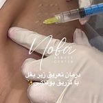 کلینیک زیبایی و لیزر مو زائد نوبا