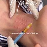 کلینیک زیبایی و لیزر مو زائد نوبا
