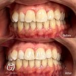 مطب دندانپزشکی دکتر فاطمه قانعی گلبهار