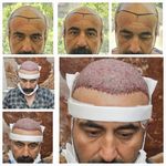 کلینیک زیبایی پوست و مو آتریسا