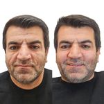 مطب زیبایی دکتر یوسف نظری