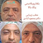 مركز ليزر و مطب زيبايی دكتر محمودآبادی