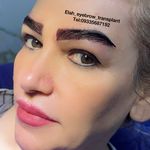 کاشت ابرو الی راز