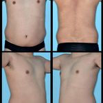 فتوگرافی پزشکی مظلومی