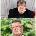 کاشت مو تخصصی سحر تلوری