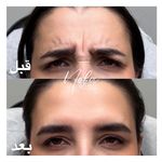 کلینیک زیبایی و لیزر مو زائد نوبا