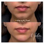 کلینیک زیبایی و لیزر مو زائد نوبا