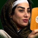 کاشت ابرو شادی حسینی