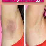 مرکز لیزر مو های زائد کندلا دکتر حجازی