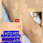 مرکز لیزر مو های زائد کندلا دکتر حجازی