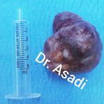 دکتر مهدی اسدی