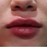 کلنیک پوست مو زیبایی آدینا