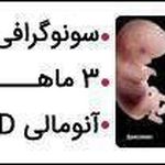 سونوگرافی شبانه روزی