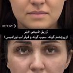 کلینیک زیبایی پل