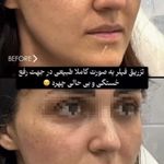 کلینیک زیبایی پل