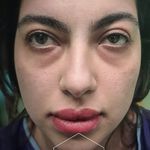 کلینیک زیبایی پل