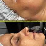 خدمات تخصصي پوست و تيرگي هاي بدن محبوبه