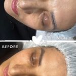 خدمات تخصصي پوست و تيرگي هاي بدن محبوبه