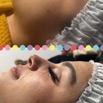 خدمات تخصصي پوست و تيرگي هاي بدن محبوبه