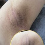 خدمات تخصصي پوست و تيرگي هاي بدن محبوبه