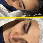 خدمات تخصصي پوست و تيرگي هاي بدن محبوبه