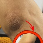 خدمات تخصصي پوست و تيرگي هاي بدن محبوبه