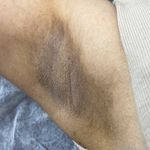 خدمات تخصصي پوست و تيرگي هاي بدن محبوبه