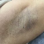 خدمات تخصصي پوست و تيرگي هاي بدن محبوبه