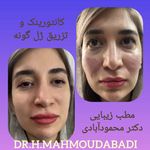 مركز ليزر و مطب زيبايی  دكتر محمودآبادی