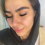 مرکز پیرسینگ،چال لپ و میکرودرمال ایدا