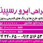اپیلاسیون رسپینا