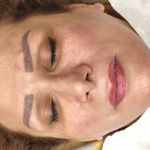 فیشال درمانی و پاکسازی پوست میرجلیلی