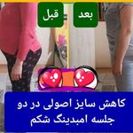 طب سنتی عامری (حجامت و بادکش)