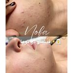 کلینیک زیبایی و لیزر مو زائد نوبا