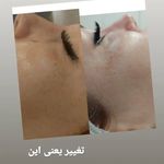 خدمات تخصصی پوست و مو مریم نصیرپور