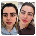 کلینیک زیبایی مهر دخت آتوسا