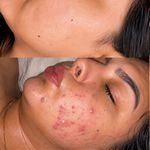 پاکسازی پوست و مو مهسام