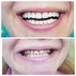 دندانپزشکی ترمیمی  زیبایی دکتر شیخ رضایی