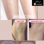 مرکز لیزر و پاکسازی پوست سحر