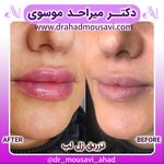 دکترمیراحدموسوی