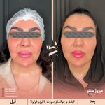 مرکز پزشکی و زیبایی میروژ سنتر