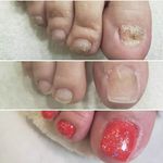 خدمات تخصصی ناخن آذر