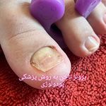 پدیکور و پودولوژیSD