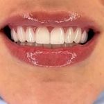 دندانپزشکی آلما دکتر فضل اللهی