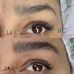 مرکز میکروبلیدینگ فیبروز ابرو