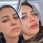 کلینیک بلا