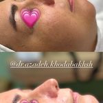مطب زیبایی آرا