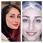 کلینیک زیبایی امیران جراحی